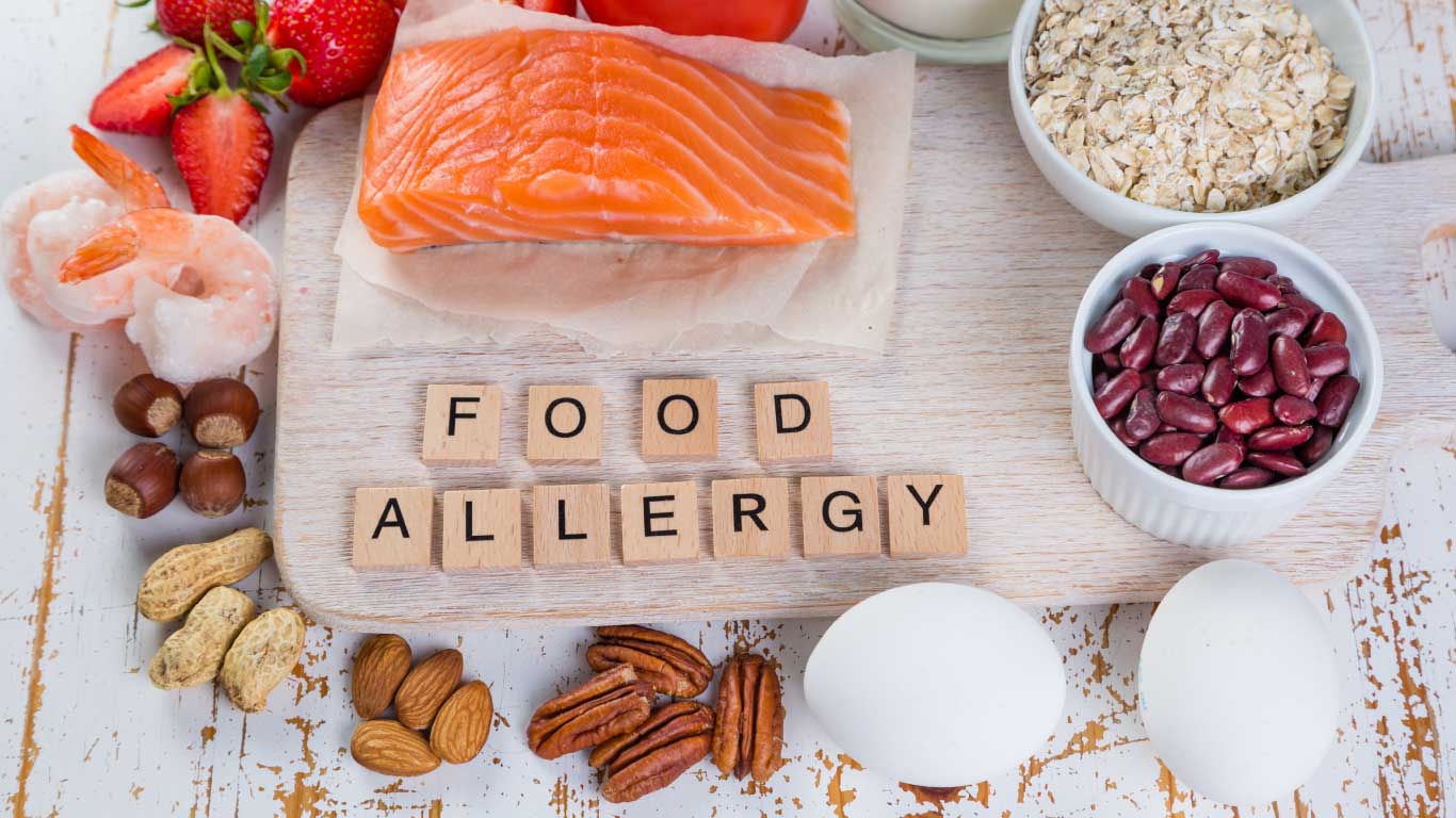 Big 9 Food Allergens